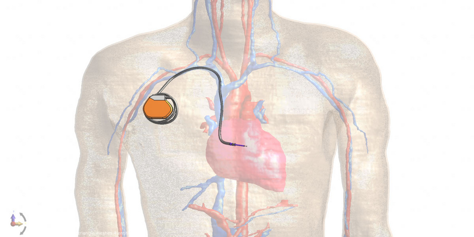 EMF Störfestigkeitsuntersuchungen (Grafik: Seibersdorf Labor GmbH)
