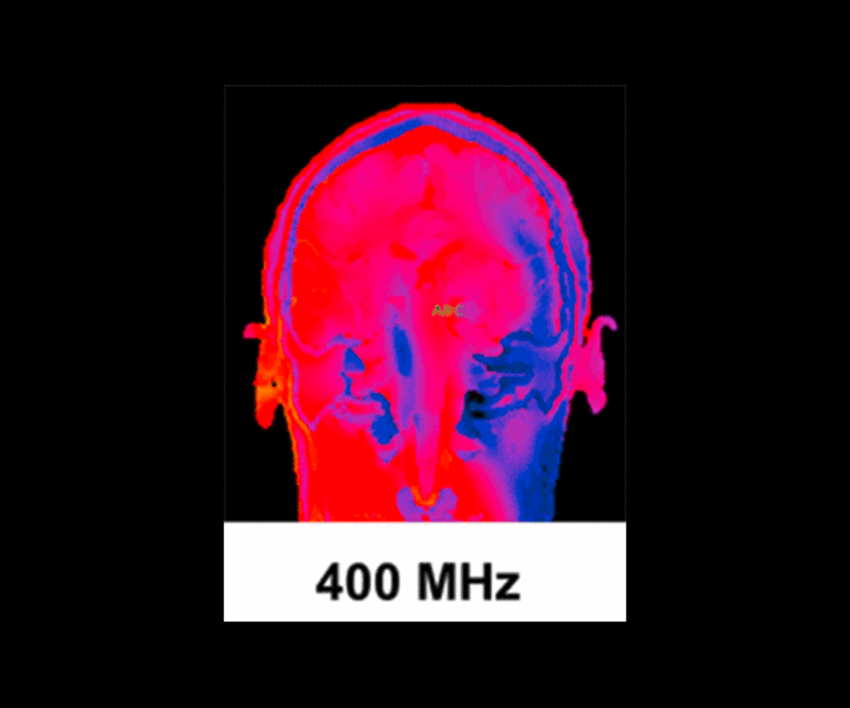 SAR (Grafik: Seibersdorf Labor GmbH)