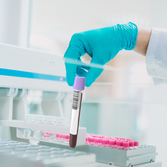 Chemical Analytics (Foto: AdobeStock)